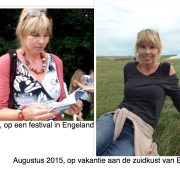 voor en na foto collageen